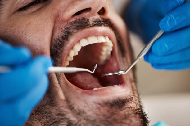 Dental X-Rays and Imaging in Dewey, OK